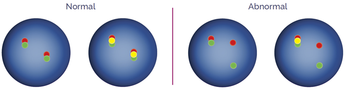 Dual-color breakapart probes