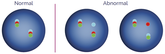 Tri-color breakapart probes