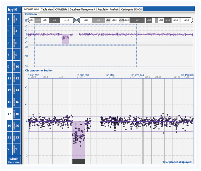 Figure 2: Detection of a 3.6Mb deletion on chromosome 17 in sample NA18324.