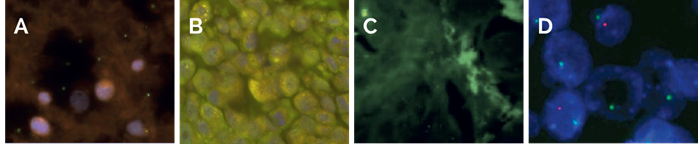 Figure 1. Example FISH images of (A) Under-fixation of a blood smear, (B) Insufficient pre-treatment of FFPE tissue, (C) Under-digestion of FFPE tissue and (D) Over-digestion of FFPE tissue