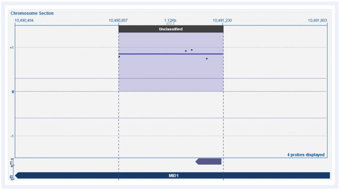 CytoSure Constitutional v3 array probes across MID1 gene displayed using CytoSure Interpret Software