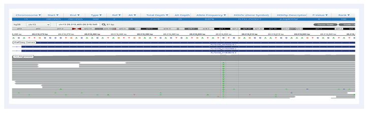 Figure 3: Example of a SNV detection FLT3 c.2503 G>T (p.Asp835Tyr).