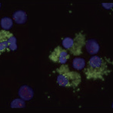 Inadequate Signals With CD138+ Cells