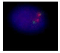 IGH Plus Breakapart (LPH 070) using 5ul probe + 5ul Cytocell Hybridisation A (HA500L)